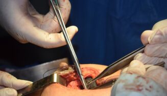 Chino Hills Plastic Surgery