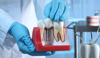 Front Tooth Root: Tooth Extraction, Treatment